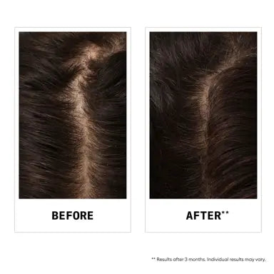 Nioxin Hair Fall Defense Shampoo - Shampoo for Hair Loss 1000ml - On Line Hair Depot